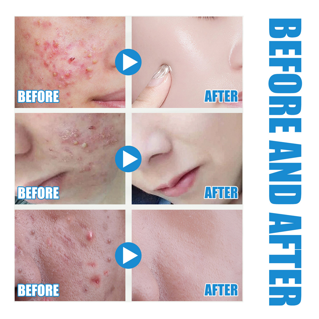 Hyaluronic Acid Hydrating Serum