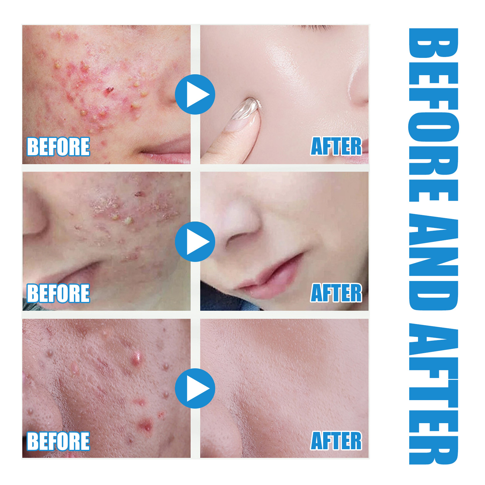 Hyaluronic Acid Hydrating Serum